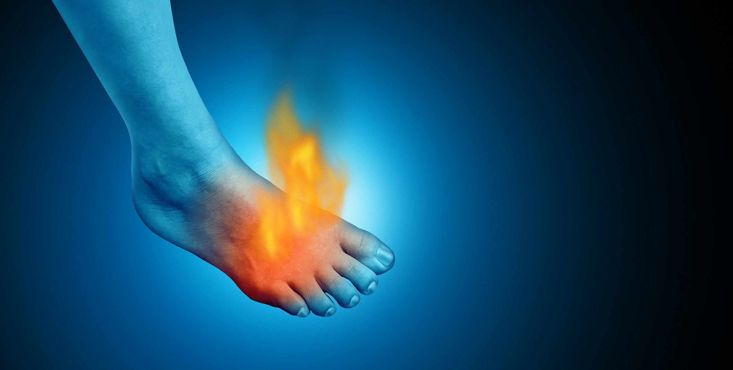 Burns and Blisters in Lanzarote Heat Raise Questions About Transition Safety