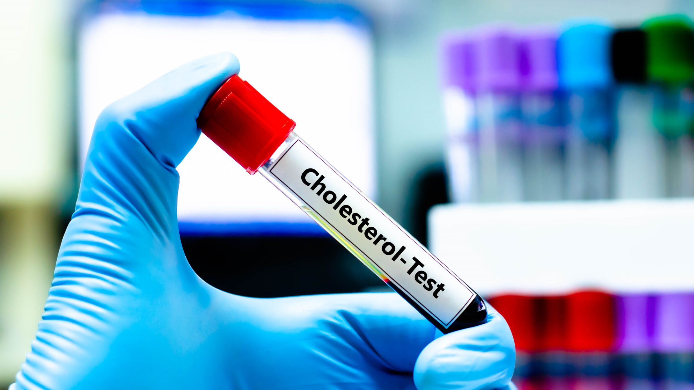 Should All Middle-Aged Triathletes Get Advanced Lipid Testing? A Doctor Weighs In.